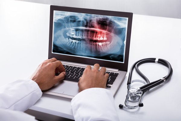 digital xrays dentist chicago